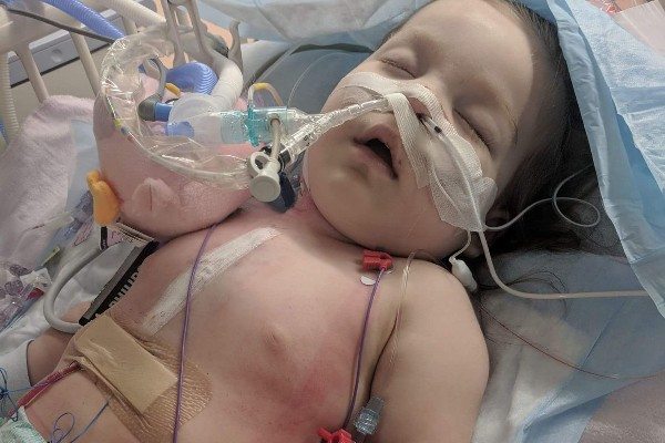 Toddler fighting for her life – family needs help